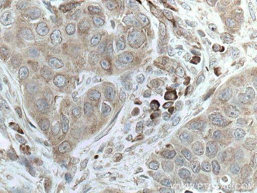 [67005-1-IG-20UL] SRP54 Monoclonal antibody
