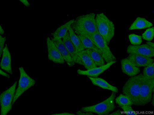 [67006-1-IG-20UL] RRM2 Monoclonal antibody