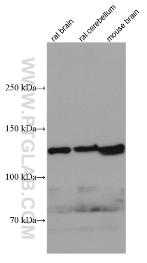 [67009-1-IG-150UL] KIF5A Monoclonal antibody
