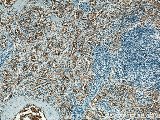 [67014-1-IG-20UL] ICAM4 Monoclonal antibody