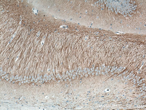 [67015-1-IG-20UL] MAP2 Monoclonal antibody