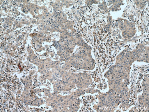 [67016-1-IG-20UL] COMMD1 Monoclonal antibody