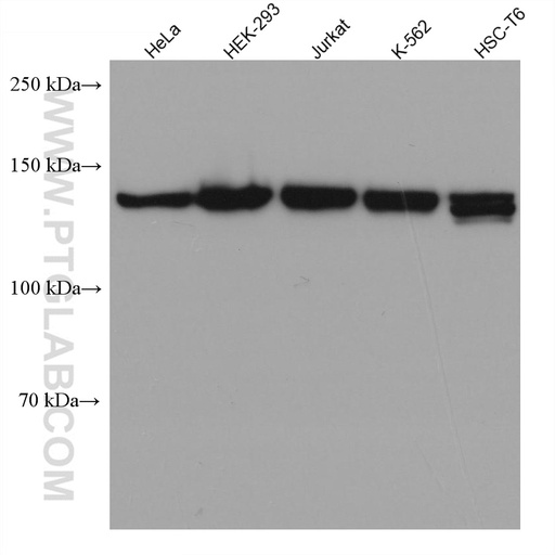 [67022-1-IG-150UL] TIMELESS Monoclonal antibody