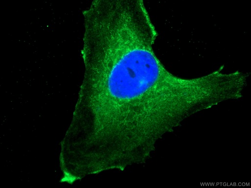 [67032-1-IG-150UL] NEU1 Monoclonal antibody