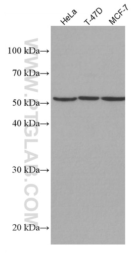 [67033-1-IG-150UL] CYP1B1 Monoclonal antibody