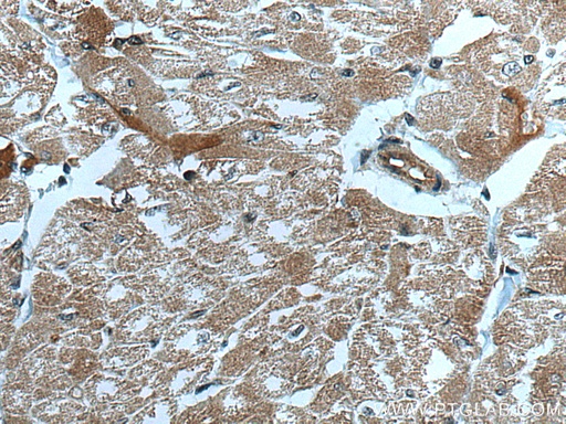 [67034-1-IG-150UL] CUL7 Monoclonal antibody
