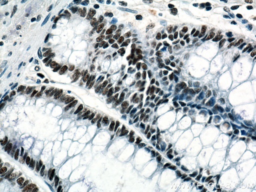 [67037-1-IG-20UL] KDM1 Monoclonal antibody