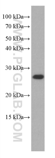 [67043-1-IG-150UL] COMMD5 Monoclonal antibody