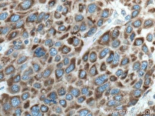 [67045-1-IG-150UL] CYP27A1 Monoclonal antibody