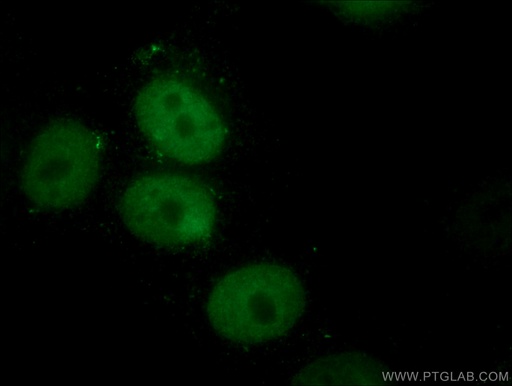 [67049-1-IG-20UL] MCM5 Monoclonal antibody