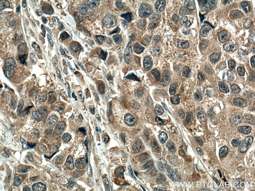 [67052-1-IG-20UL] SMAD5 Monoclonal antibody