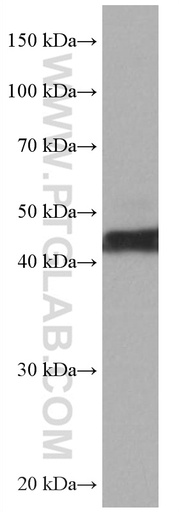 [67057-1-IG-20UL] ATX3,ATXN3 Monoclonal antibody