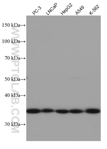 [67059-1-IG-20UL] REDD1 Monoclonal antibody