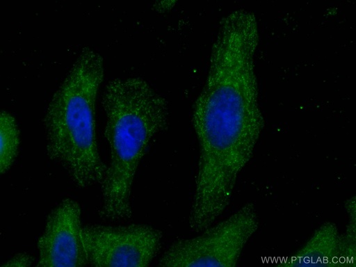 [67063-1-IG-20UL] C1QA Monoclonal antibody