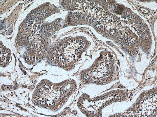 [67064-1-IG-150UL] PLCD1 Monoclonal antibody
