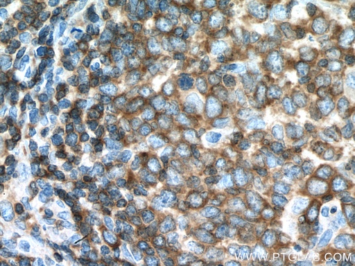 [67067-1-IG-150UL] ADRBK1 Monoclonal antibody