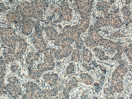 [67071-1-IG-150UL] PI3 Kinase p110 Alpha Monoclonal antibody