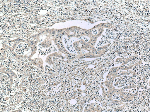 [67072-1-IG-20UL] ASK1 Monoclonal antibody