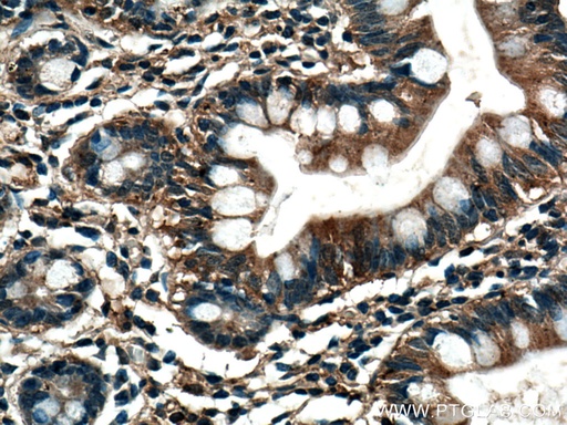 [67073-1-IG-20UL] TRIM40 Monoclonal antibody