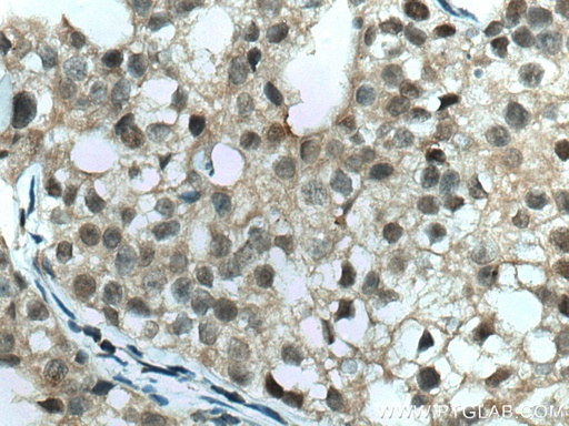 [67076-1-IG-20UL] TFAP2A,AP-2 Monoclonal antibody