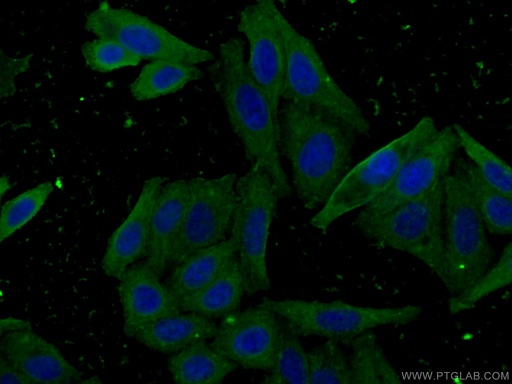 [67079-1-IG-20UL] CES1 Monoclonal antibody