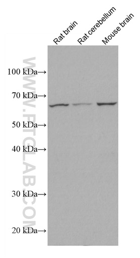 [67083-1-IG-20UL] EAAT2 Monoclonal antibody