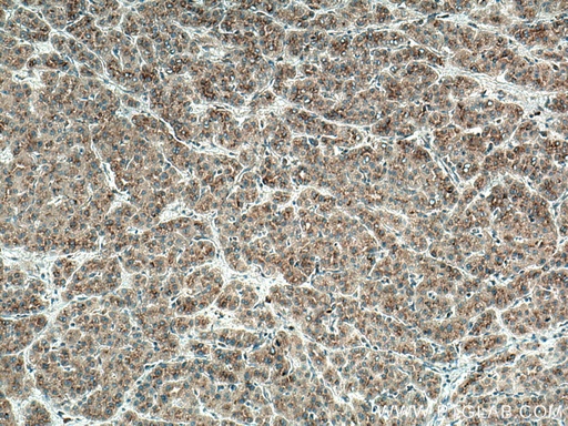 [67088-1-IG-20UL] SDC2 Monoclonal antibody