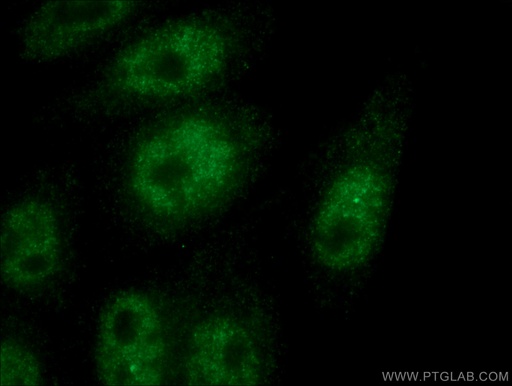 [67091-1-IG-20UL] HORMAD1 Monoclonal antibody