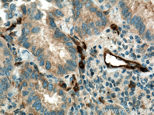 [67094-1-IG-150UL] RALB Monoclonal antibody