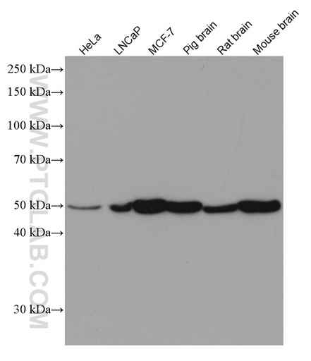 [67099-1-IG-150UL] PICK1 Monoclonal antibody