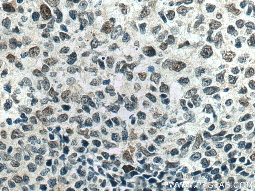 [67100-1-IG-20UL] MAD2L2 Monoclonal antibody