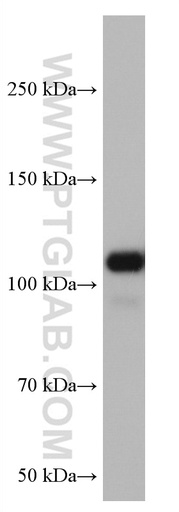 [67108-1-IG-20UL] VAV2 Monoclonal antibody