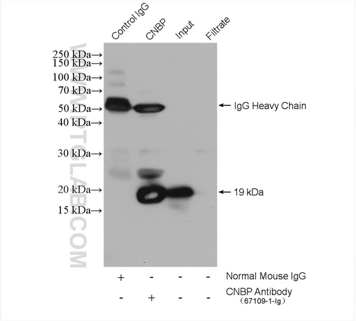 [67109-1-IG-20UL] CNBP Monoclonal antibody