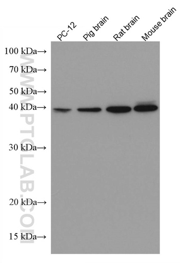 [67111-1-IG-150UL] DLX5 Monoclonal antibody
