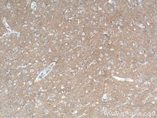 [67115-1-IG-20UL] L1CAM Monoclonal antibody