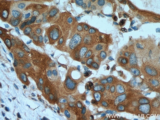 [67118-1-IG-20UL] RAB3D Monoclonal antibody