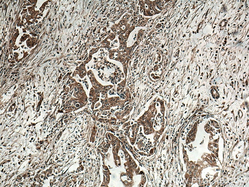 [67120-1-IG-20UL] INA Monoclonal antibody