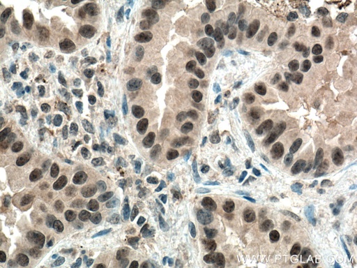 [67121-1-IG-20UL] PI3 Kinase p110 Beta Monoclonal antibody