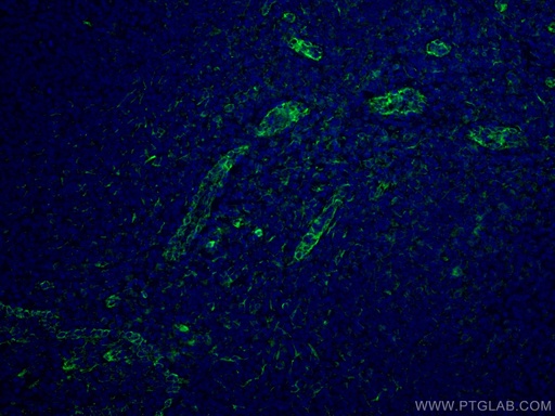 [67128-1-IG-20UL] ABCA7 Monoclonal antibody
