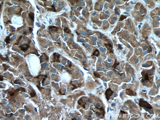 [67131-1-IG-150UL] FSHB Monoclonal antibody