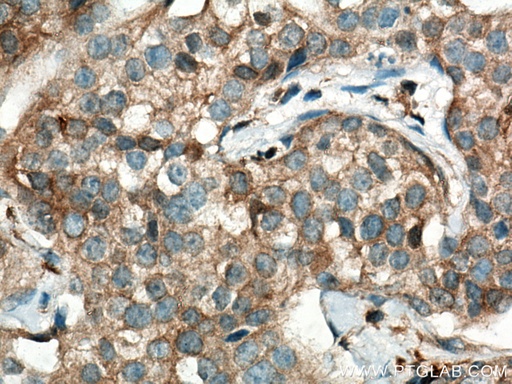 [67136-1-IG-20UL] TRIM21 Monoclonal antibody