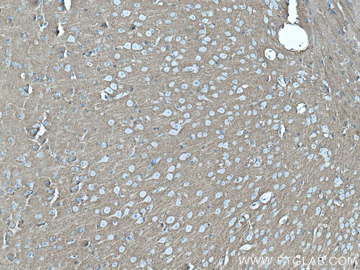 [67137-1-IG-150UL] STXBP1 Monoclonal antibody