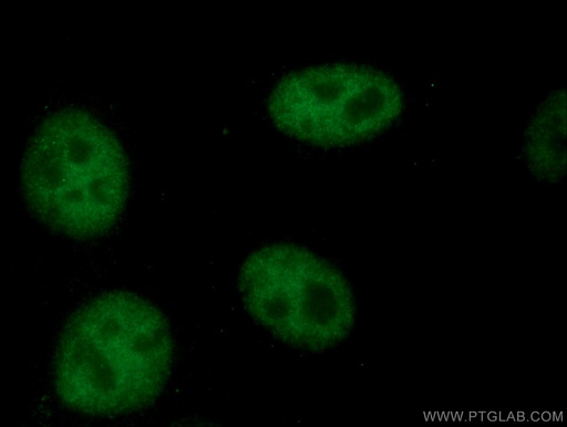 [67140-1-IG-20UL] TCF3 Monoclonal antibody