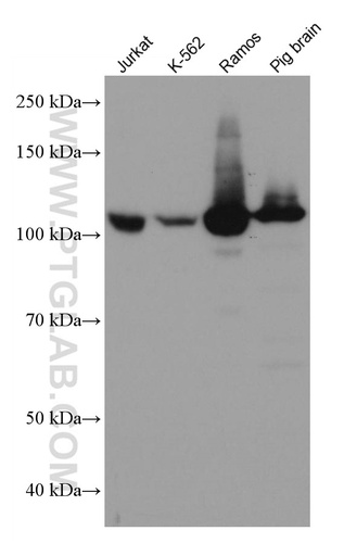 [67141-1-IG-150UL] PTK2B Monoclonal antibody