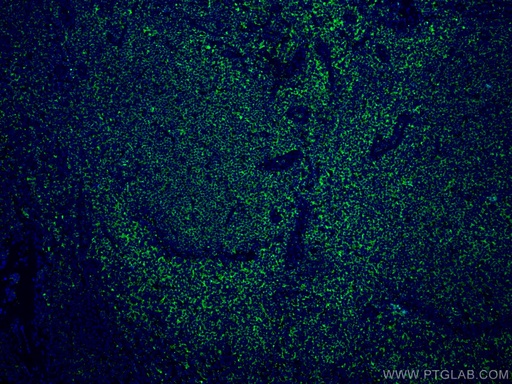 [67143-1-IG-20UL] RIAM,APBB1IP Monoclonal antibody