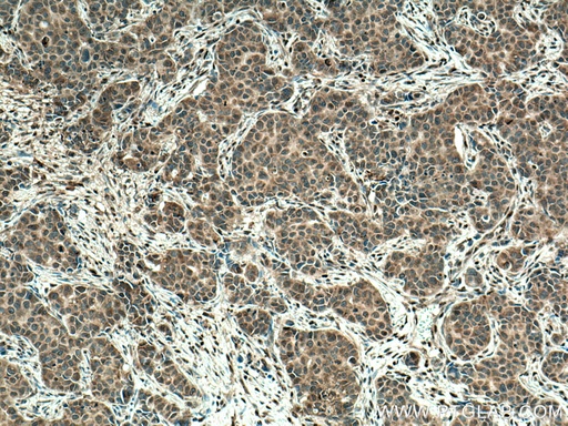 [67144-1-IG-150UL] URG4 Monoclonal antibody