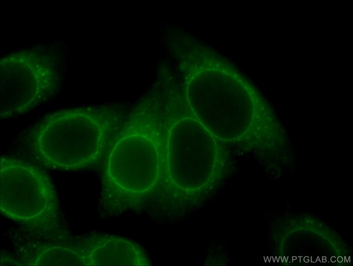 [67146-1-IG-150UL] RANGAP1 Monoclonal antibody