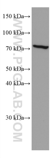 [67152-1-IG-150UL] FGL2 Monoclonal antibody