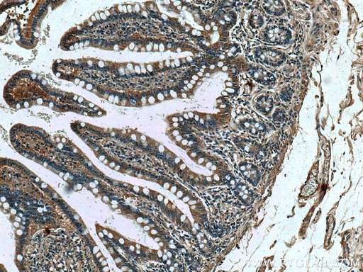 [67156-1-IG-20UL] DEFA1 Monoclonal antibody