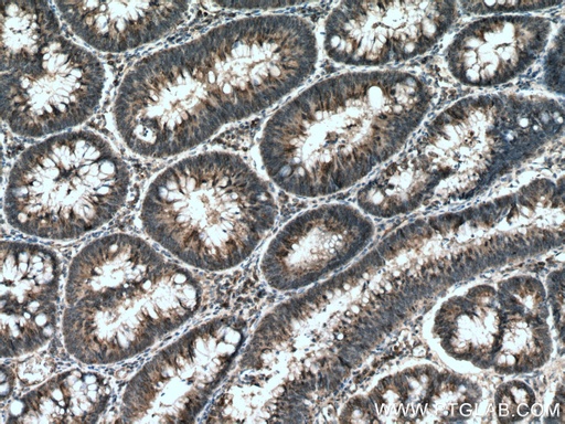 [67163-1-IG-20UL] HIP1 Monoclonal antibody